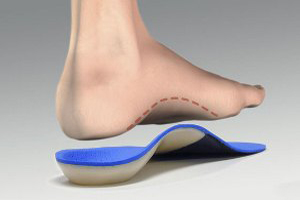 what-can-cause-flat-feet