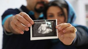 آشنایی با اولین سونوگرافی بعد از بارداری