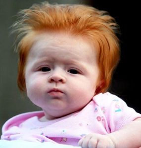 مو قرمز شدن کودک به چه علت است؟